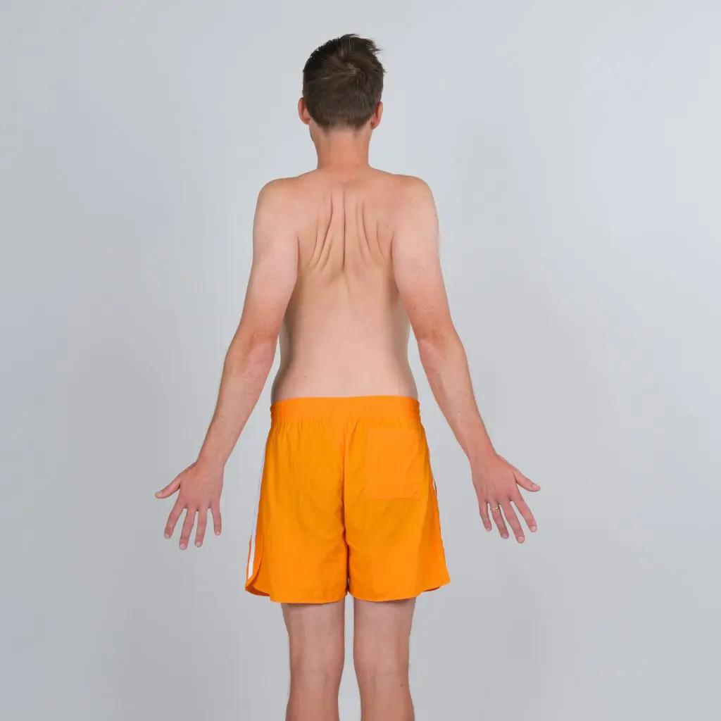 skulderbladets muskler 1