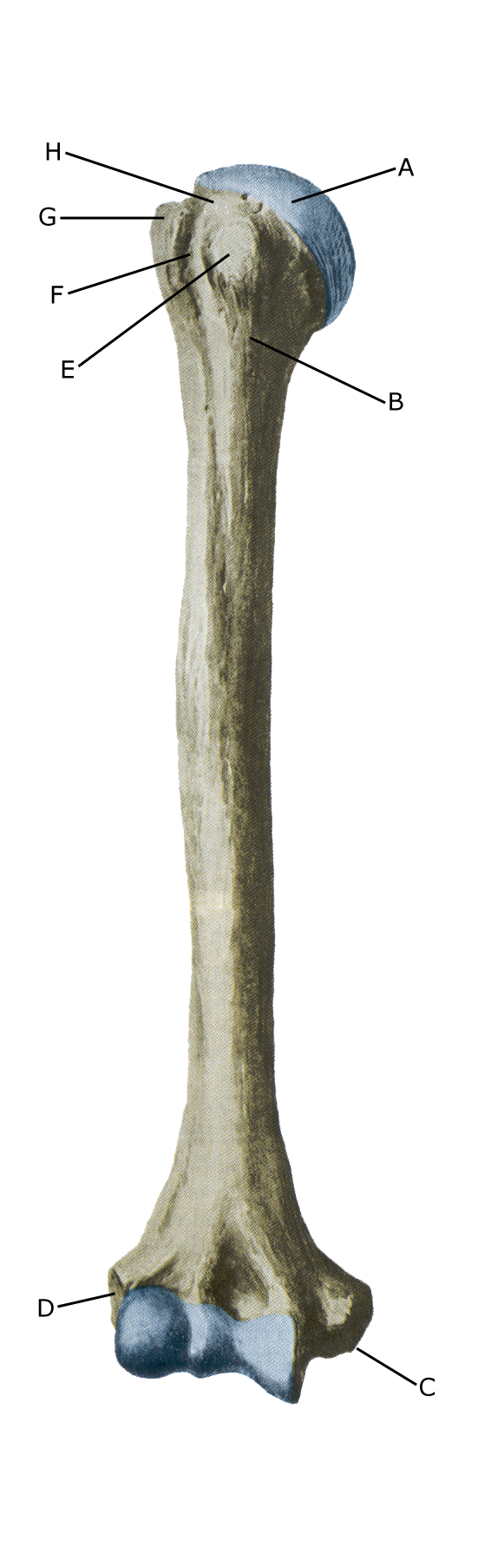 Fracture Of The Humerus At The Elbow Sportnetdoc dk